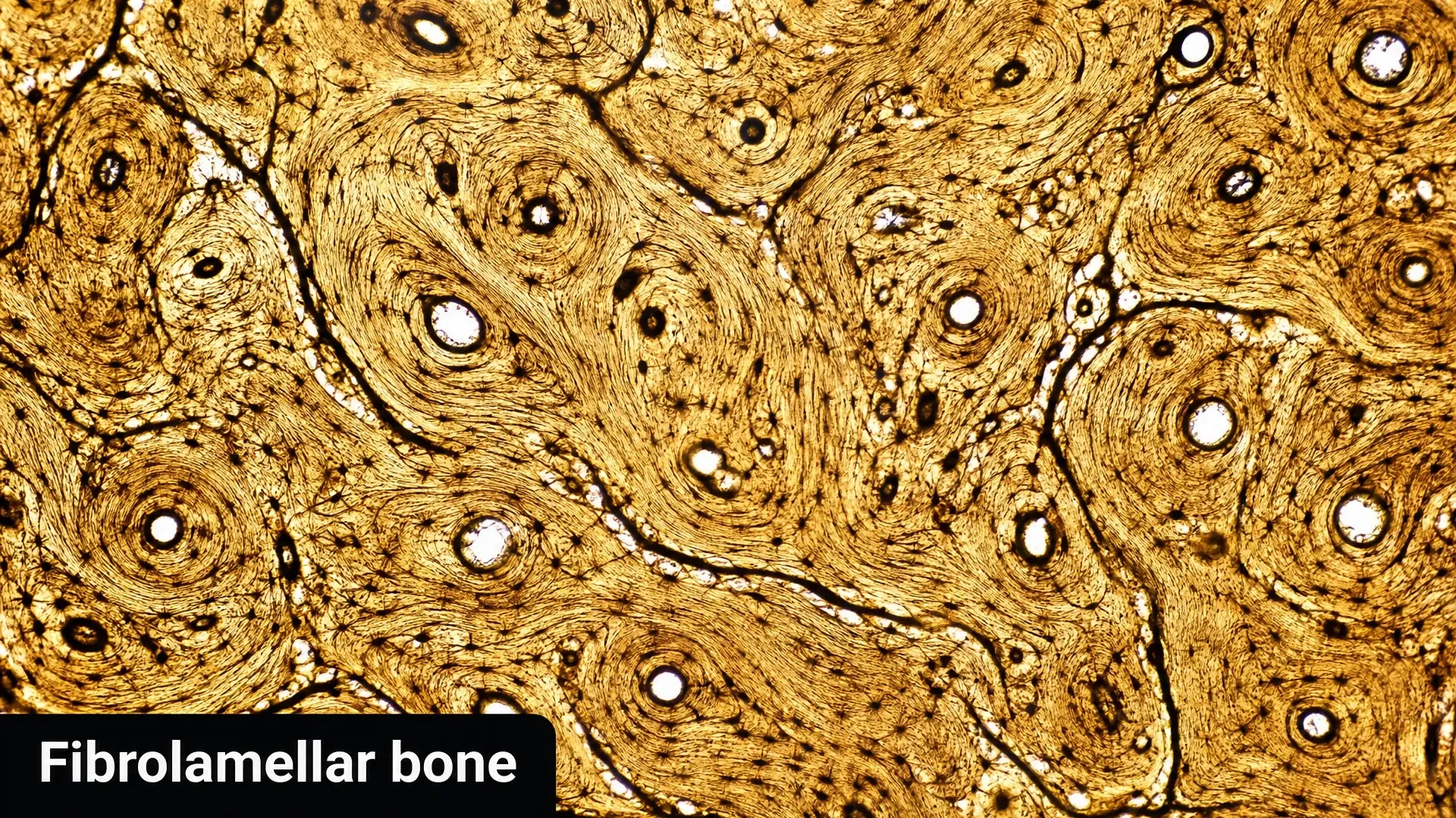 Illustrated magnified bone tissue with dense circular vascular canals labeled Fibrolamellar bone.